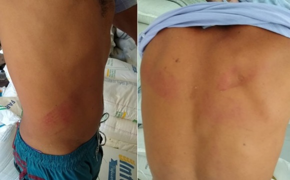 VEREADOR DE GUANAMBI É ACUSADO DE AGREDIR HOMEM COM GOLPES DE FACÃO EM PRAÇA PÚBLICA