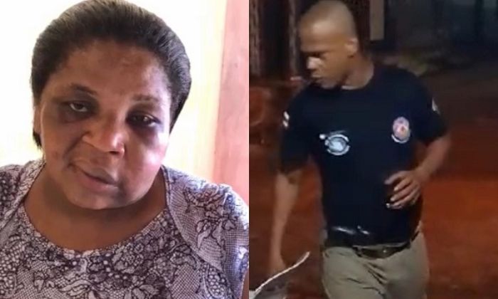 Mulher agredida por policial militar em Travessão aparece em vídeo com hematomas no rosto