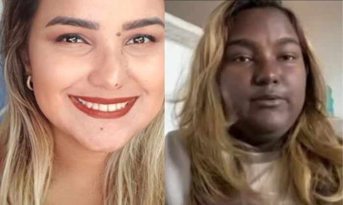 Sabrina foi diagnosticada com os problemas na adolescência